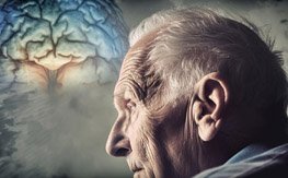 alzheimer-disease